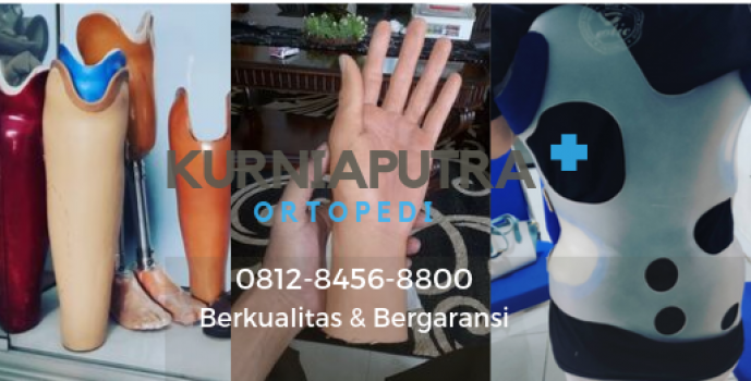 jual kaki palsu jakarta timur