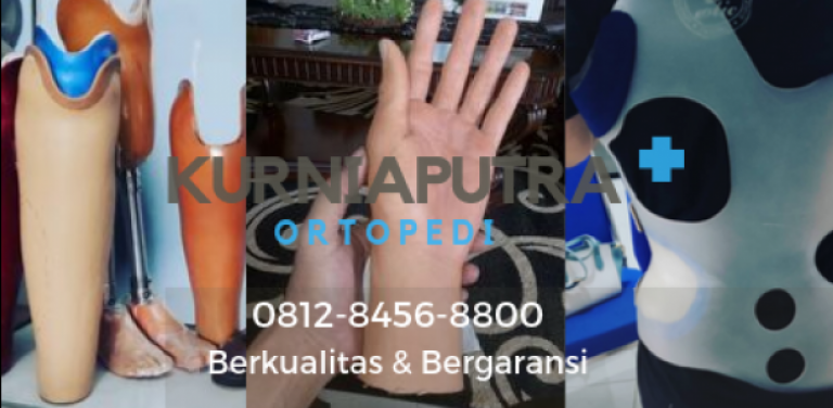jual kaki palsu anak