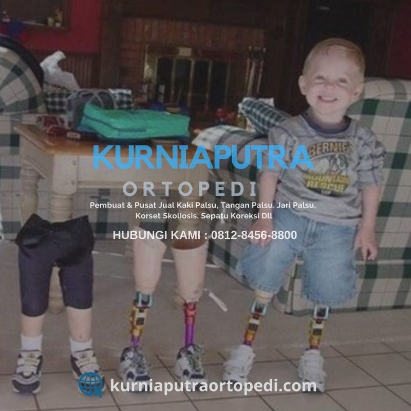 jual kaki palsu Depok