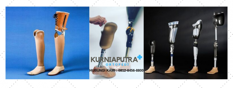 harga kaki palsu yang bagus