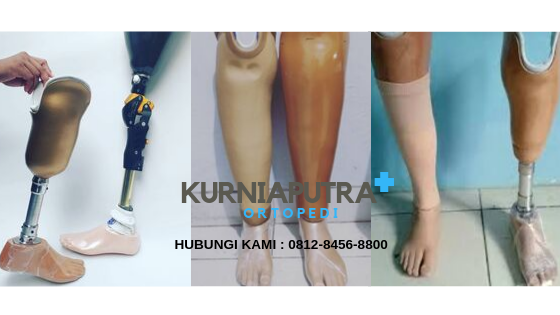 beli kaki palsu jakarta beli kaki palsu jakarta
