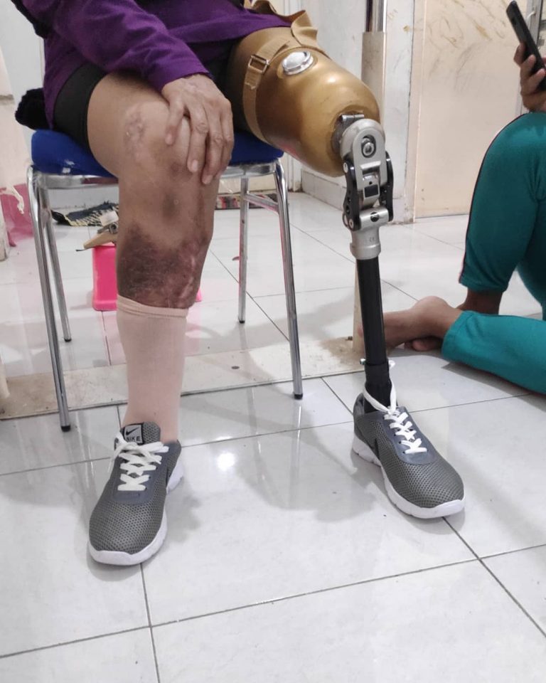 jual kaki palsu bekasi
