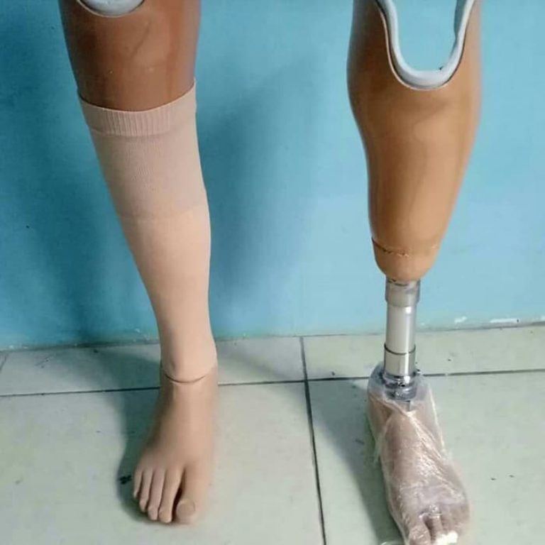 pembuat kaki palsu di bekasi