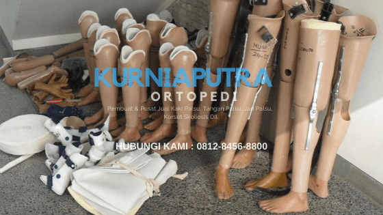 jual kaki palsu tepat lutut jual kaki palsu tepat lutut