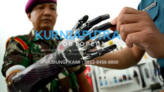 jual tangan palsu robotik