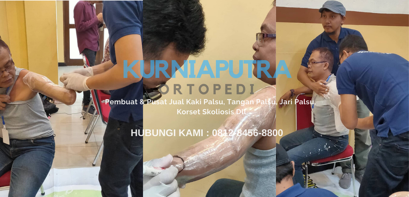 jasa pembuatan tangan palsu jasa pembuatan tangan palsu