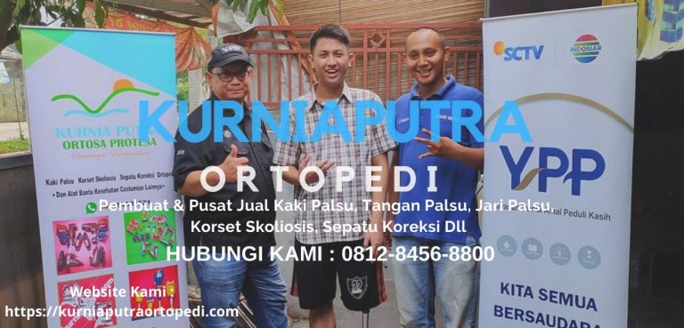 jasa pembuatan tangan palsu