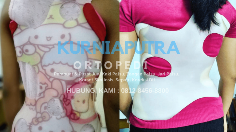 jual korset skoliosis depok