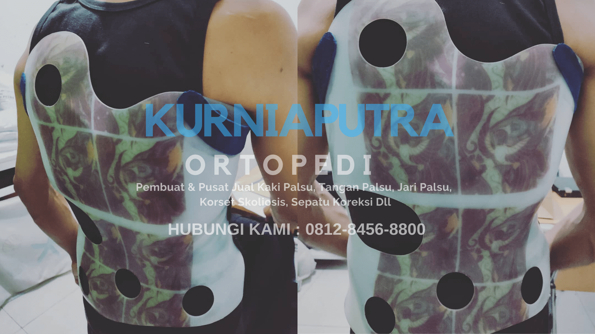jual brace skoliosis jual brace skoliosis