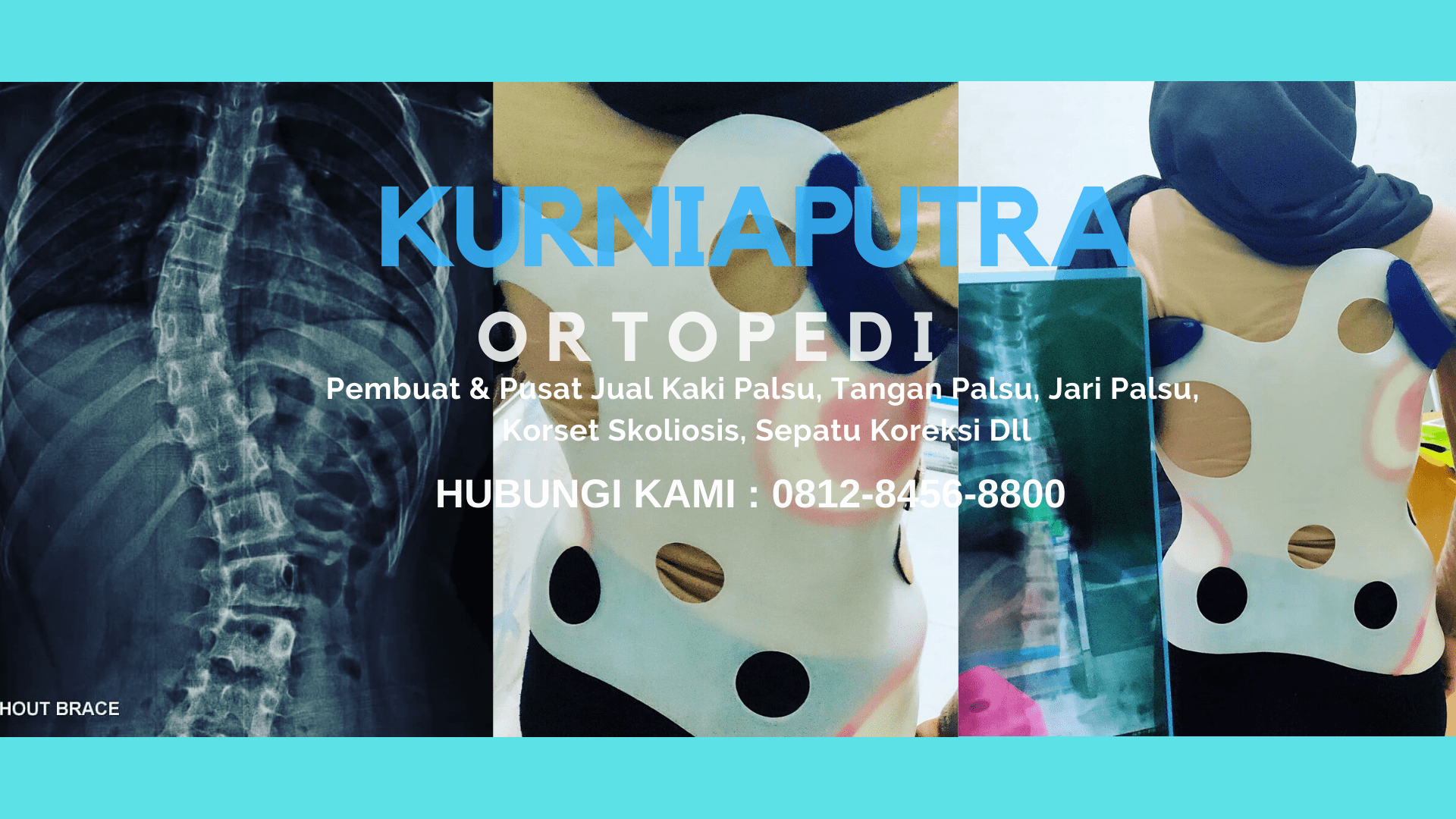 jual korset skoliosis anak ringan jual korset skoliosis anak