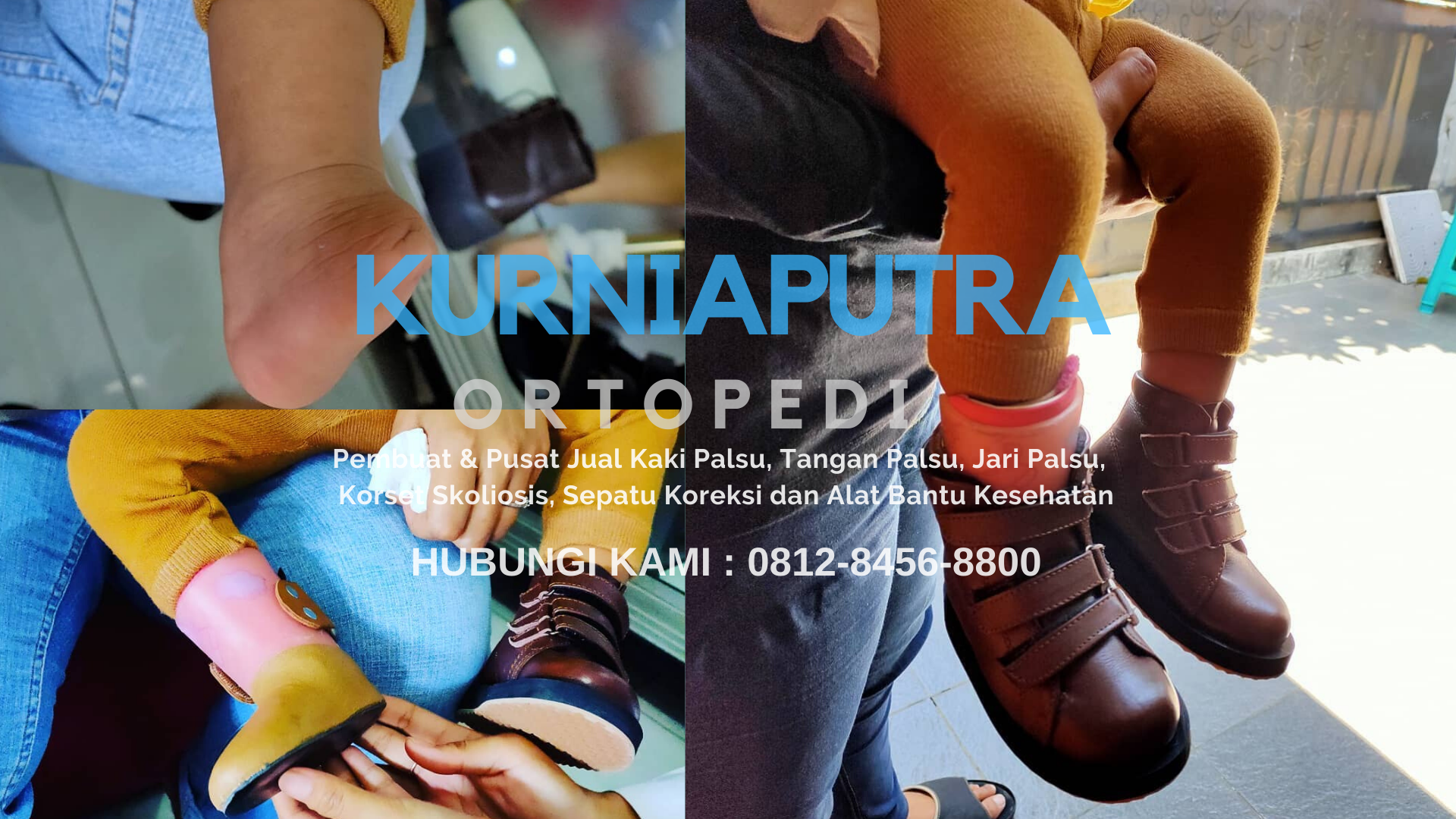 Jual Kaki Palsu Lombok