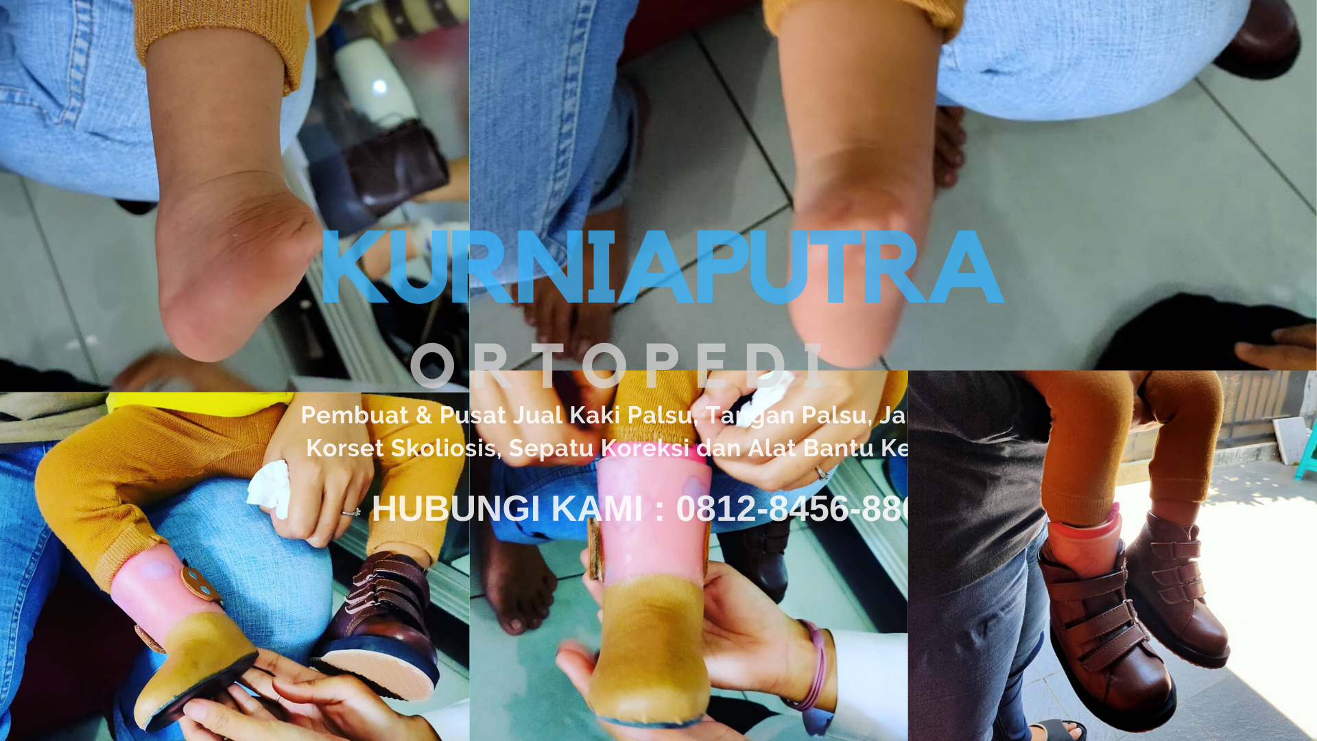 Jual Kaki Palsu Kalimantan'