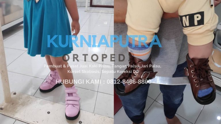 Jual Sepatu Ortopedi Anak