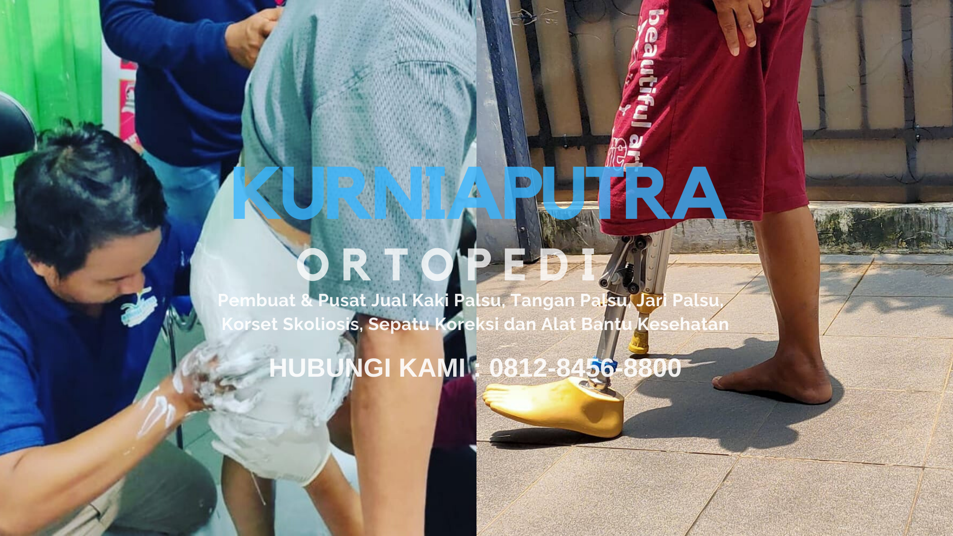 jual kaki palsu makassar
