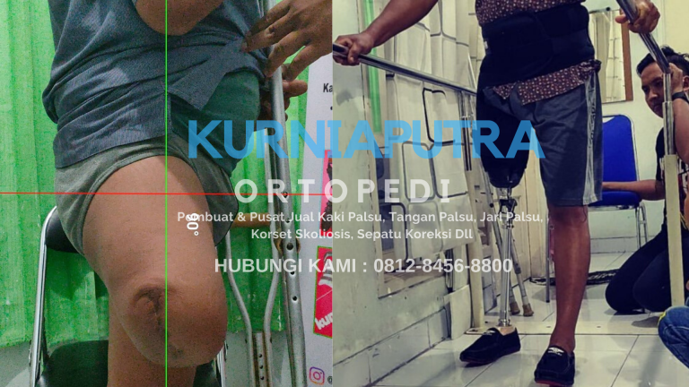 jual kaki palsu surabaya