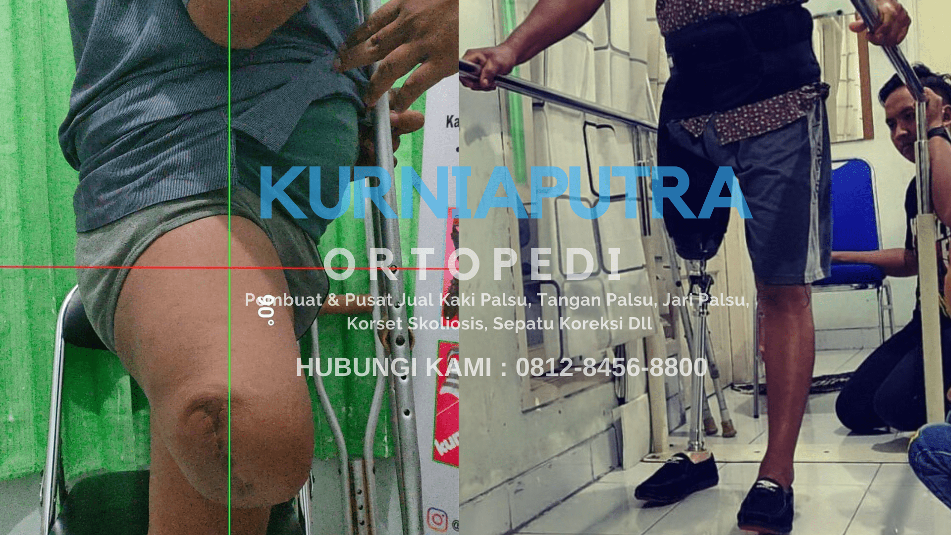 harga jual kaki palsu madiun jual kaki palsu madiun
