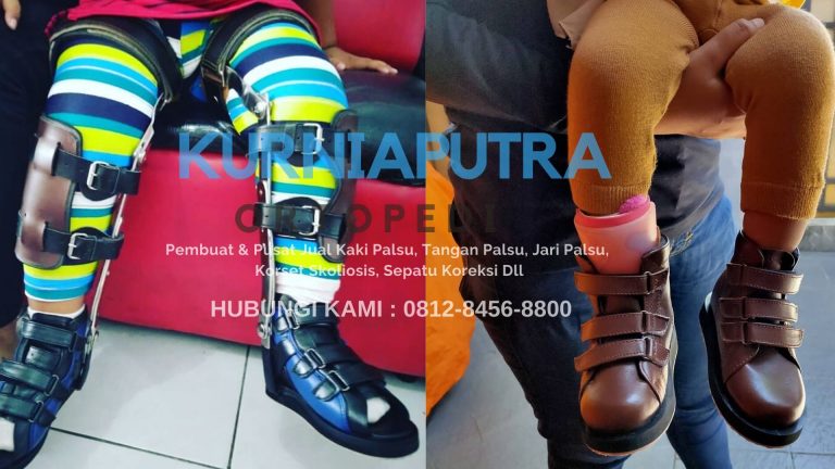 jual sepatu ortopedi di bandung
