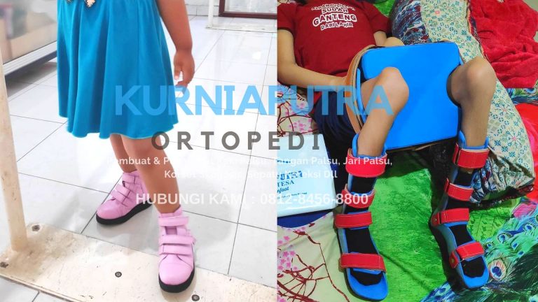 jual sepatu koreksi bekasi selatan