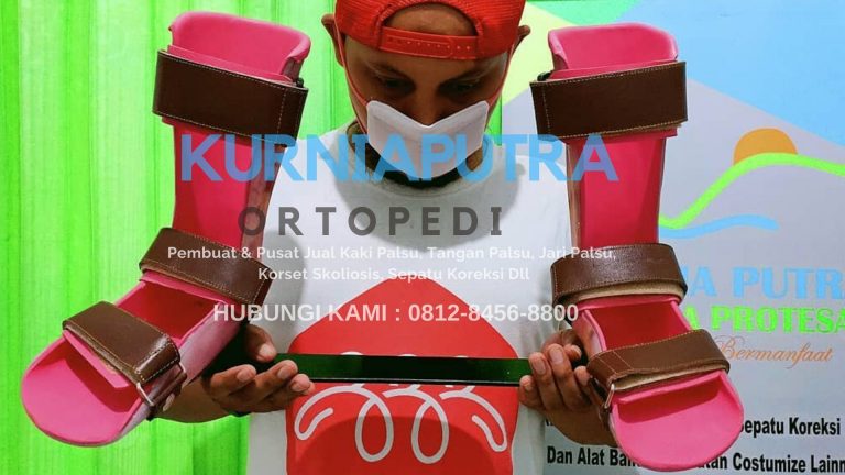 jual kaki palsu bekasi utara