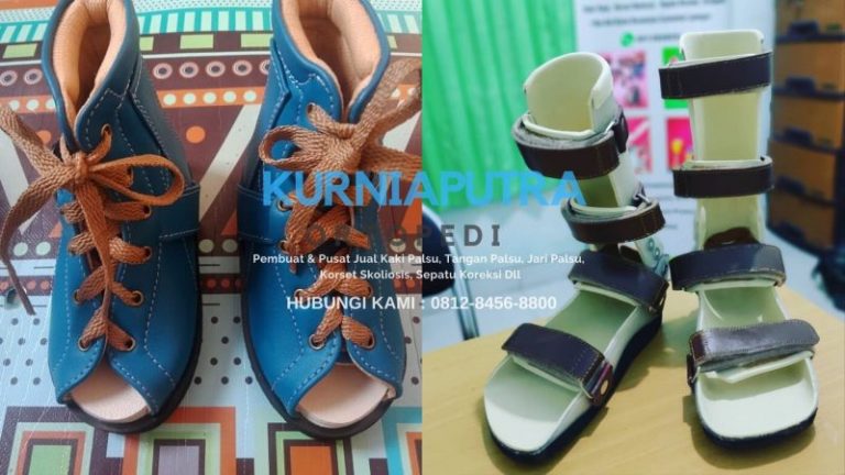 sepatu koreksi ortopedi di cirebon