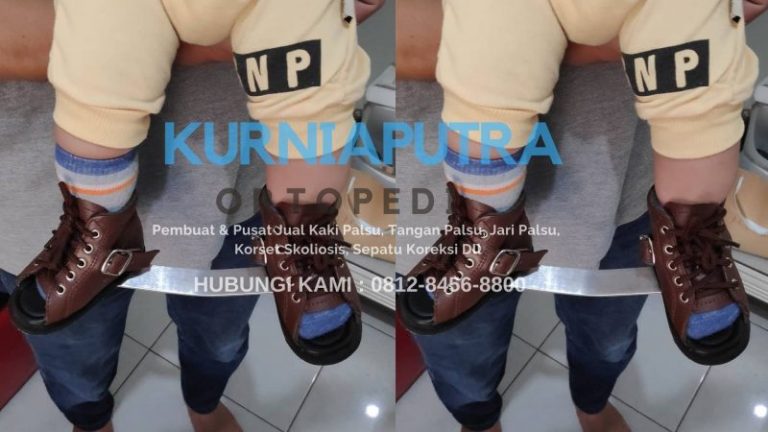 harga sepatu ortopedi bayi