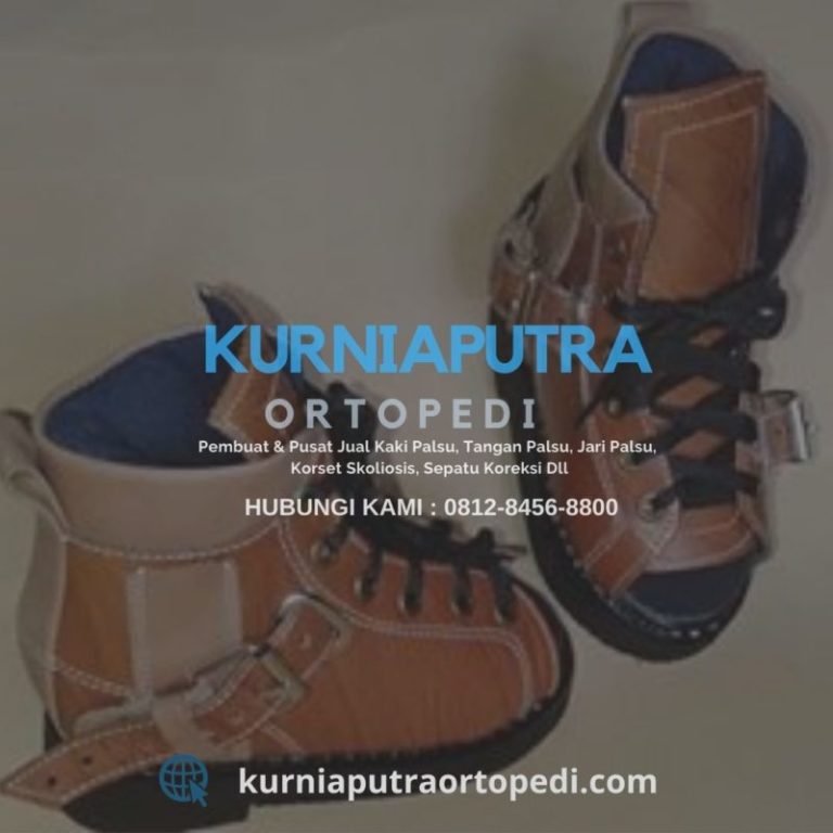 sepatu ortopedi untuk bayi