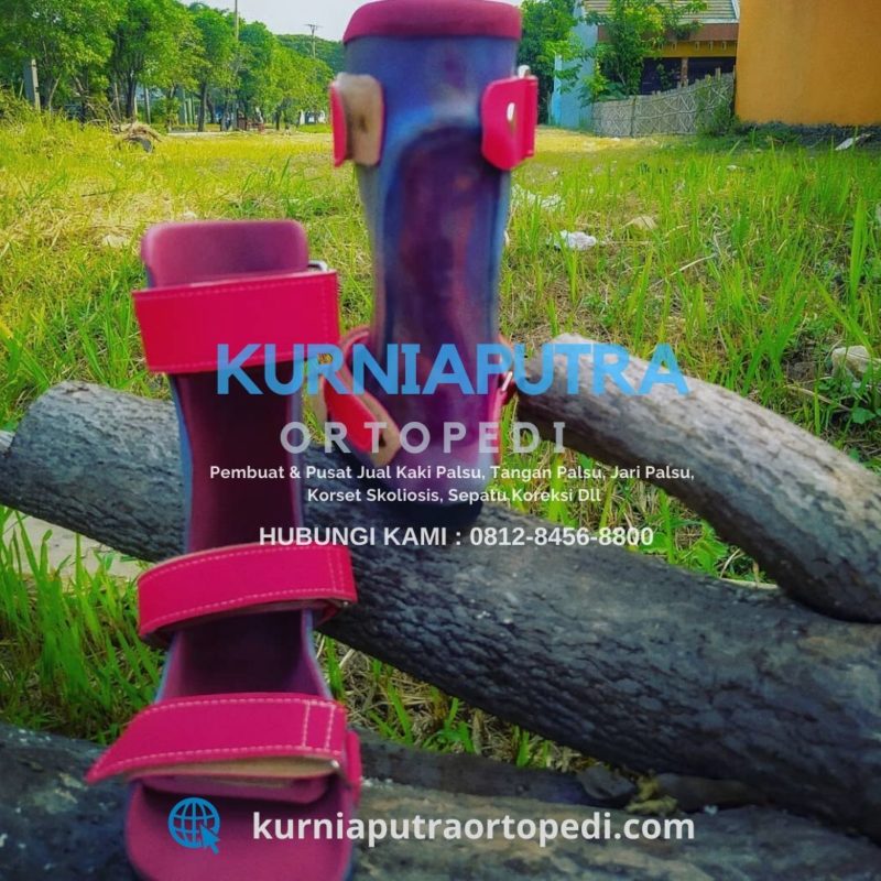Harga sepatu koreksi untuk kaki anak