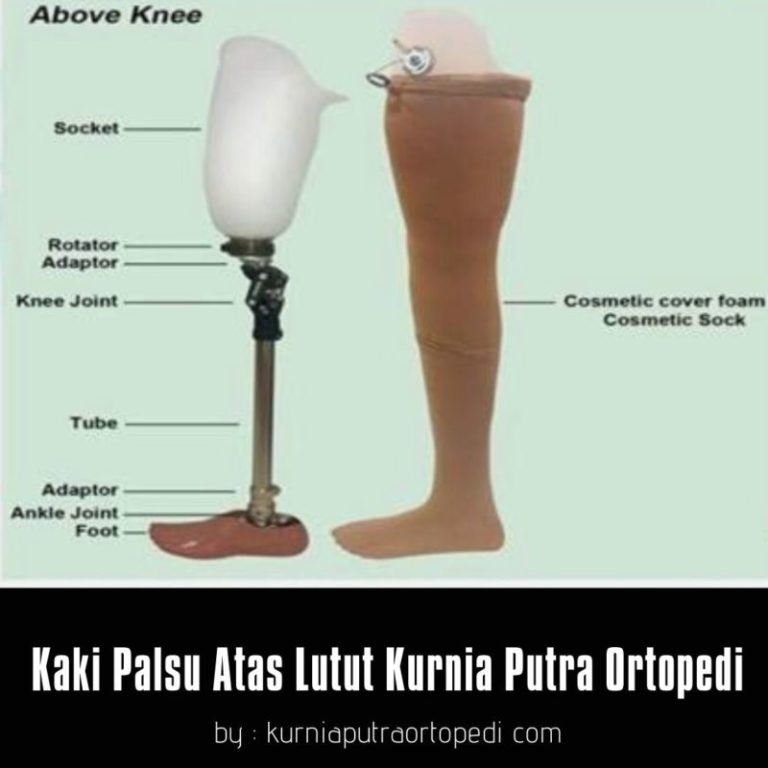 jual kaki palsu atas lutut
