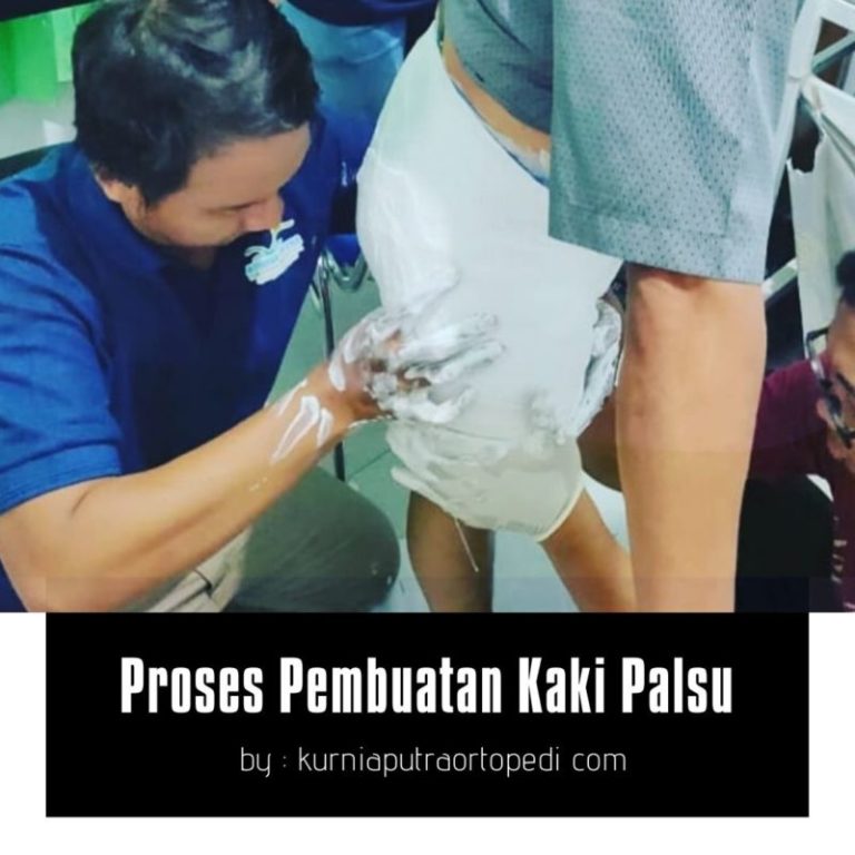 jual kaki palsu sunter