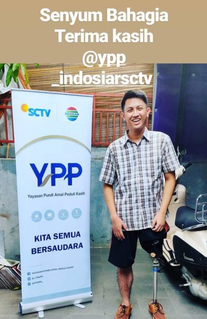 kaki palsu atas lutut lokal