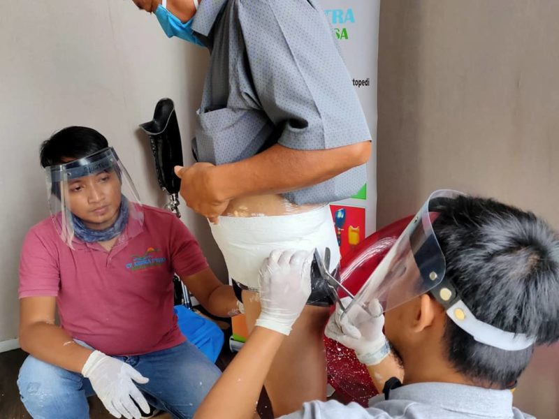 jual kaki palsu aceh