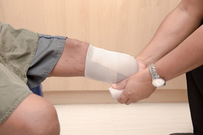 amputasi kaki adalah