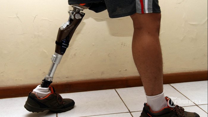 engsel kaki palsu berkualitas