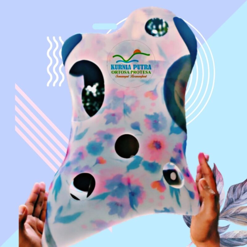 skoliosis bisa sembuh