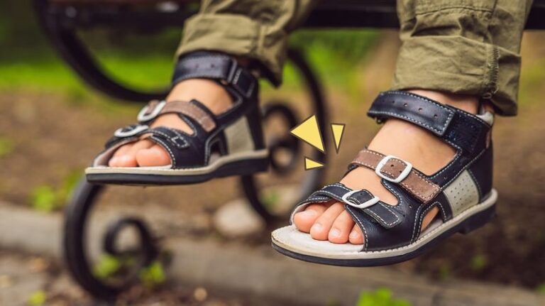 Kaki Bengkok Saat Lahir,