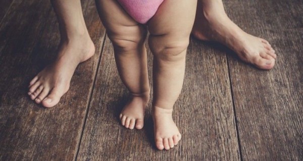 Mengatasi Kaki Pengkor