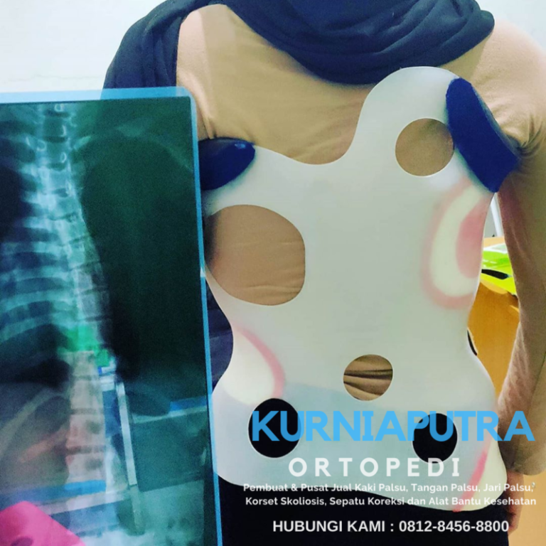 jual korset skoliosis tambun