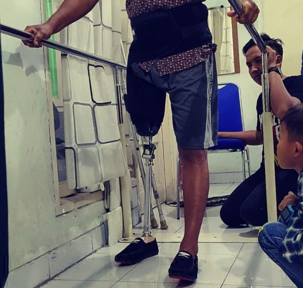 pembuat kaki palsu