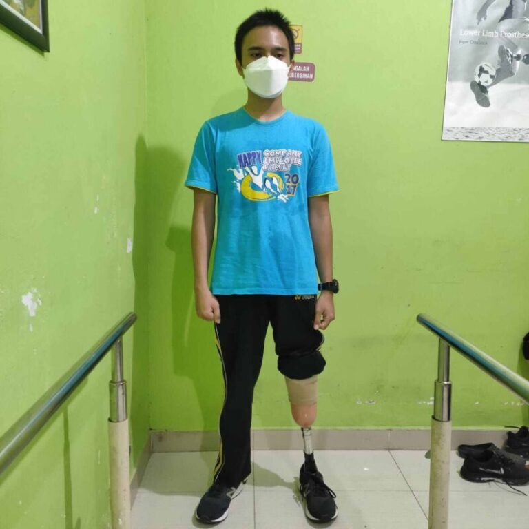 Jual Kaki Palsu Sukabumi