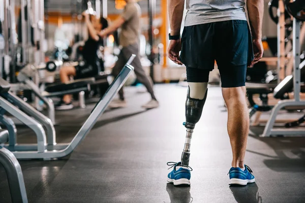 Jual Kaki Palsu di Pekalongan